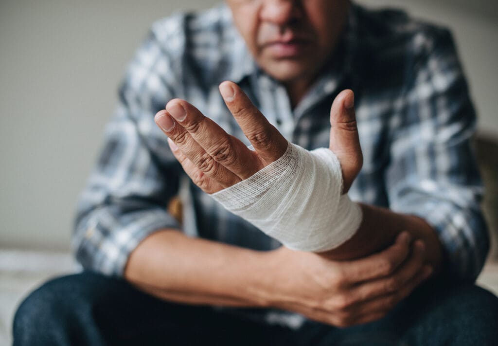 An injured person holds their hand, which is wrapped in gauze.